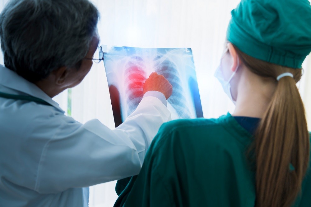 Quando uma tosse deixa de ser comum? Cinco sintomas persistentes que podem alertar para doenças graves de pulmão e  exigem avaliação médica