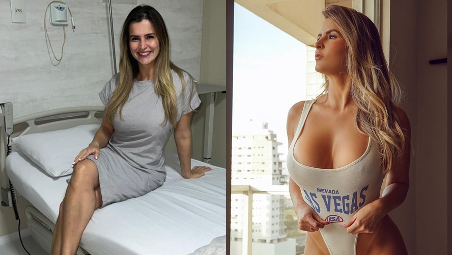 Enfermeira e criadora de conteúdo adulto muda o visual com cirurgias