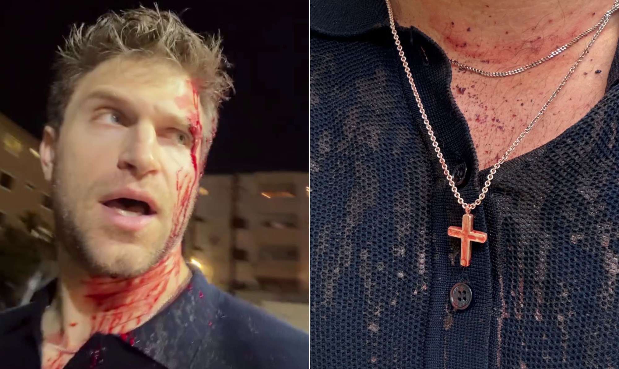 Ator de 'Pretty little liars', Keegan Allen atualiza estado de saúde após ser atacado em assalto