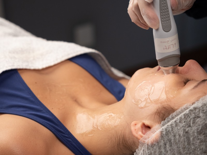 Ultrassom terapêutico avança no rejuvenescimento facial