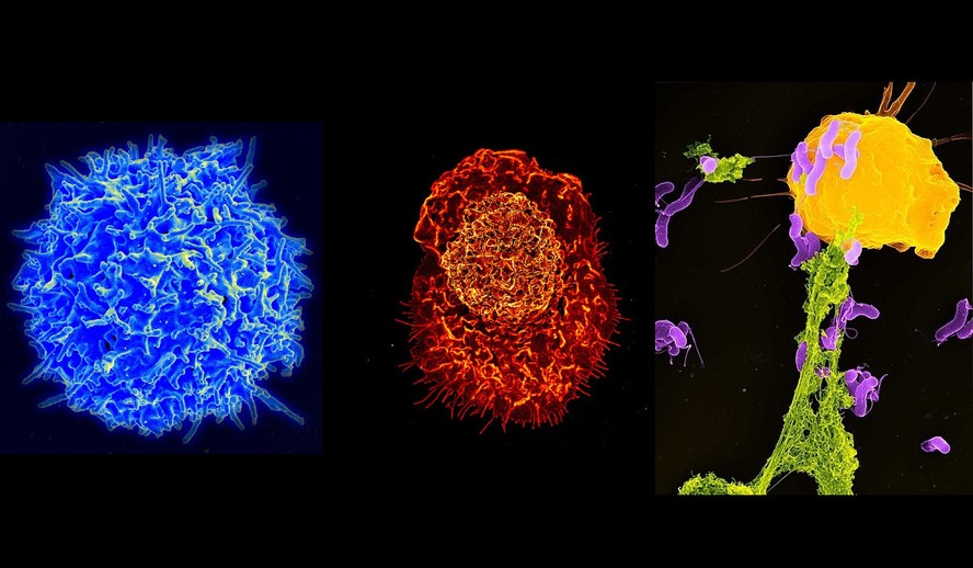 Um linfócito, um macrógago e um neutrófilo, os três principais tipos de células imunes mapeadas no estudo, em imagem de microscopia eletrônica colorizada artificialmente