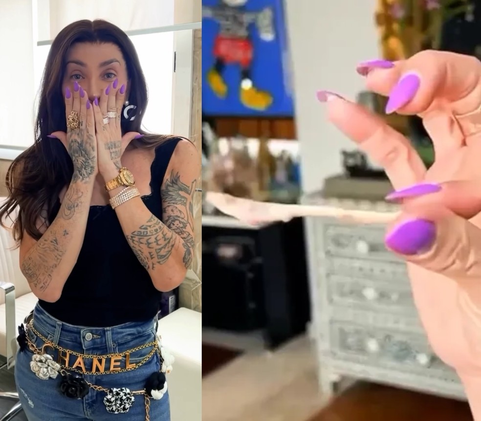 Maya Massafera revelou resultado de cirurgia no maxilar e mostrou pedaço de osso retirado — Foto: Reprodução Instagram