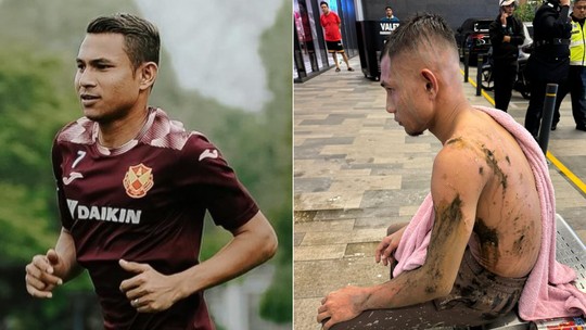 Jogador da seleção da Malásia é atacado com ácido e passa por cirurgia para enxerto de pele