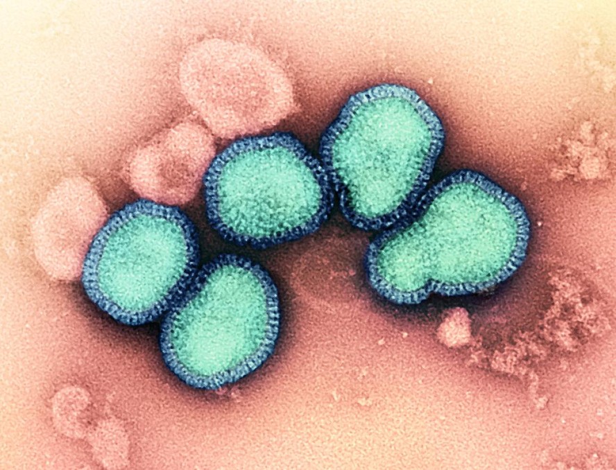 A variante H3N2 do vírus influenza tipo A, estudada na pesquisa que usou inteligência artificial