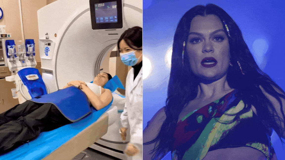 'Pensei que havia quebrado o pescoço': Cantora Jessie J é hospitalizada após bater de carro durante turnê na China