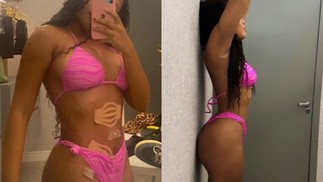 Thalyta fez lipoaspiração na barriga e preenchimento nos glúteos