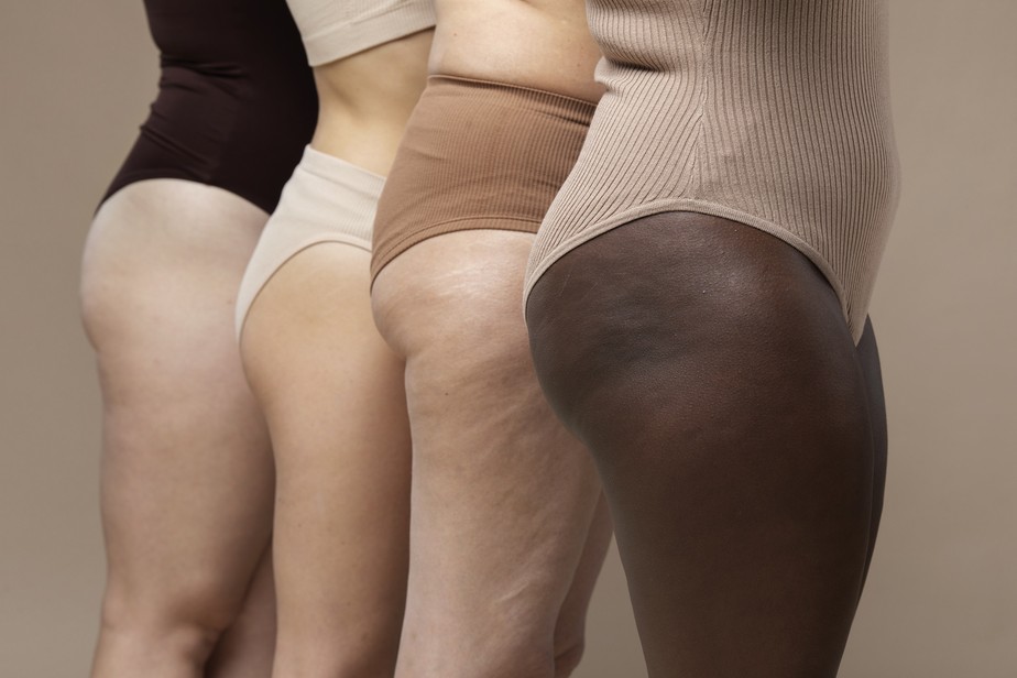 Ainda d&aacute; tempo! Dermatologistas dizem como melhorar a apar&ecirc;ncia dos furinhos  da celulite at&eacute; o carnaval