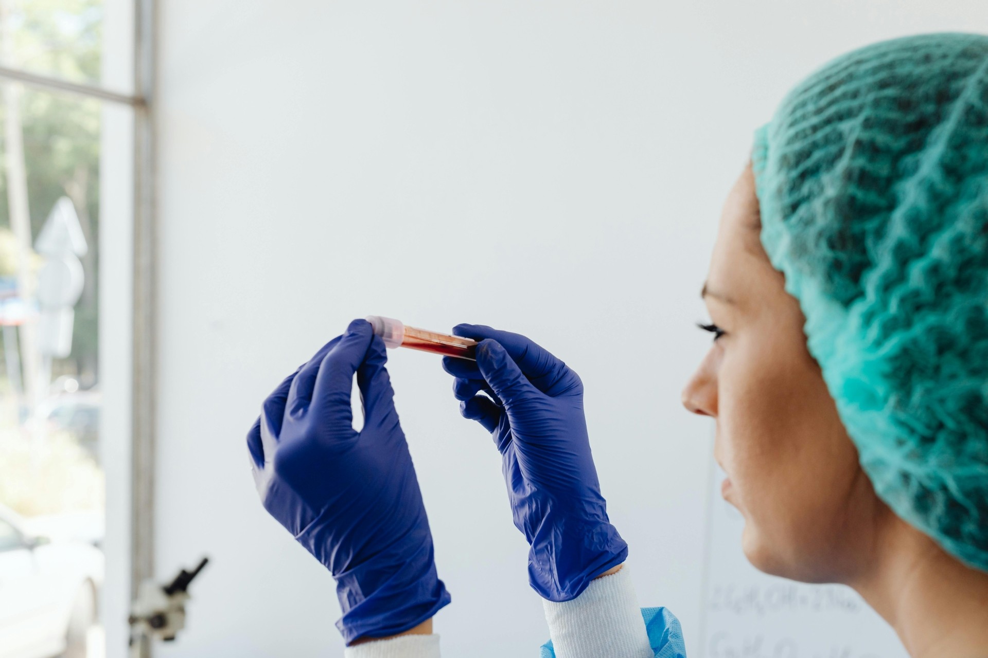 Novo exame de sangue com IA mostra o risco de 6 doenças cardiovasculares até 15 anos antes do sintomas