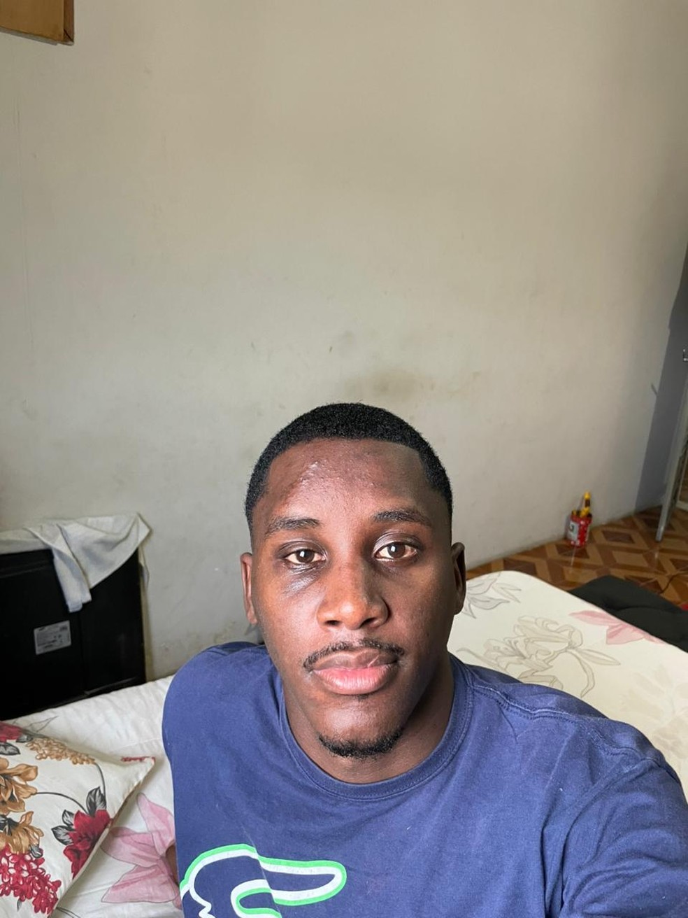 Alex Reis Peçanha Júnior, que sofreu acidente de moto em outubro do ano passado: ainda com visão dupla de um dos olhos — Foto: Arquivo pessoal