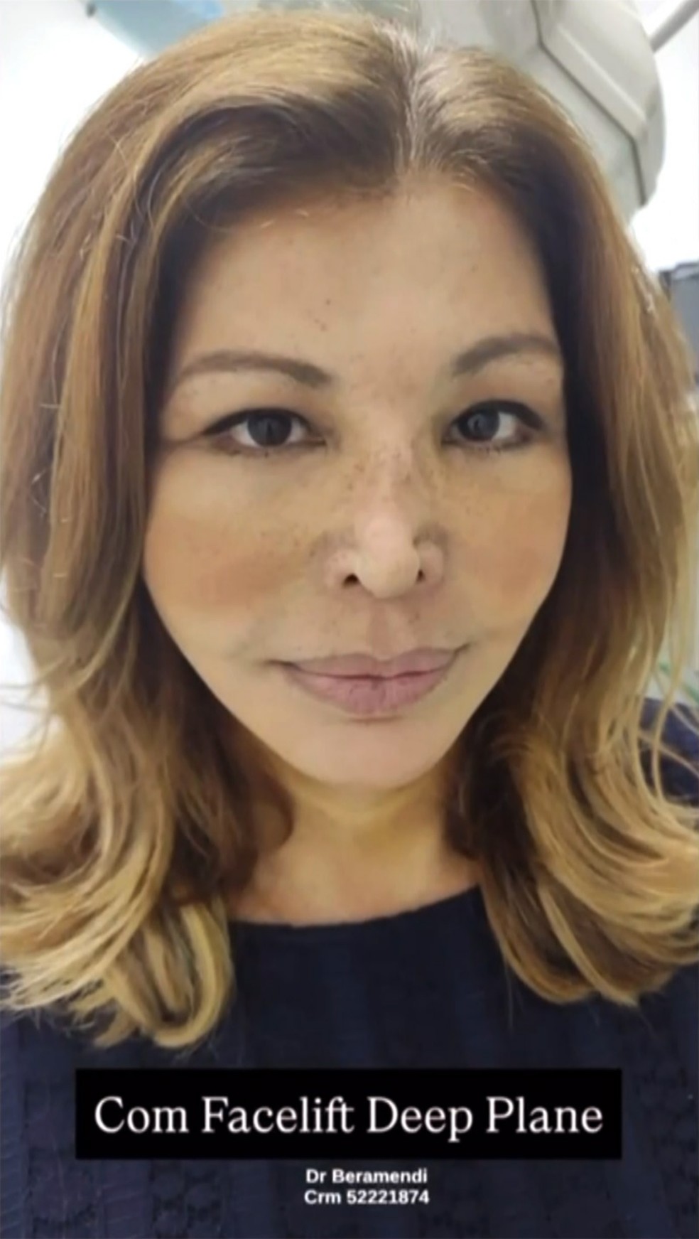 Roberta Close — Foto: Reprodução Instagram