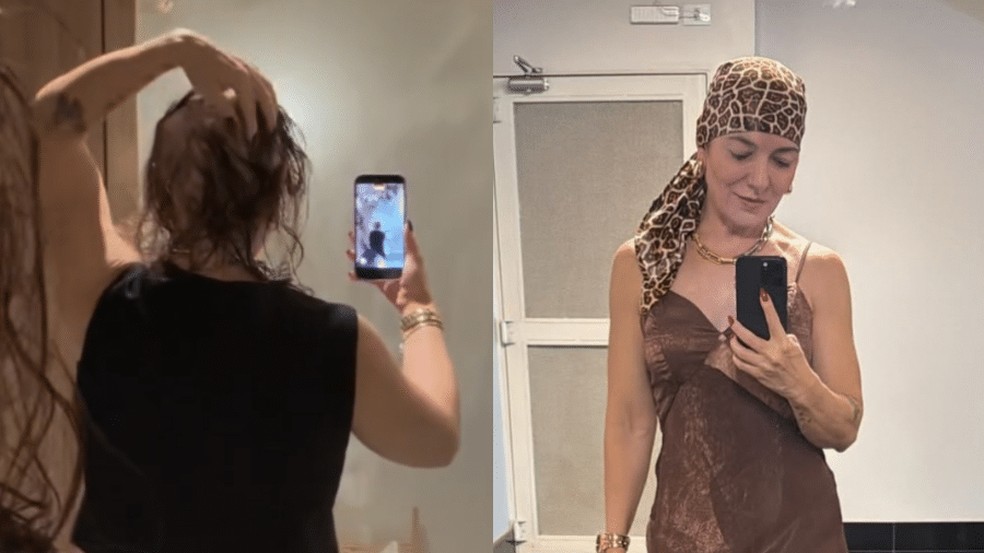 M&atilde;e de Lucas Lucco mostra impacto da alopecia areata nos cabelos; entenda a  doen&ccedil;a