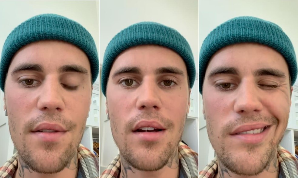 O cantor Justin Bieber publicou um vídeo no Instagram em que falou sobre o diagnóstico da síndrome de Ramsay Hunt — Foto: Reprodução / Instagram