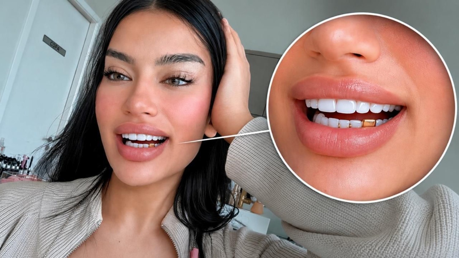 Após descobrir traição, influenciadora transforma aliança de noivado em grillz: 