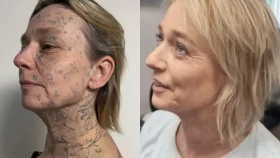 Tranforma&ccedil;&atilde;o de Joke &mdash; Foto: Reprodu&ccedil;&atilde;o/Redes Sociais