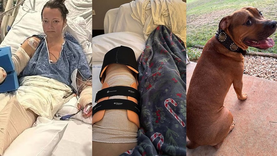 [Image: perna-amputad.jpg]