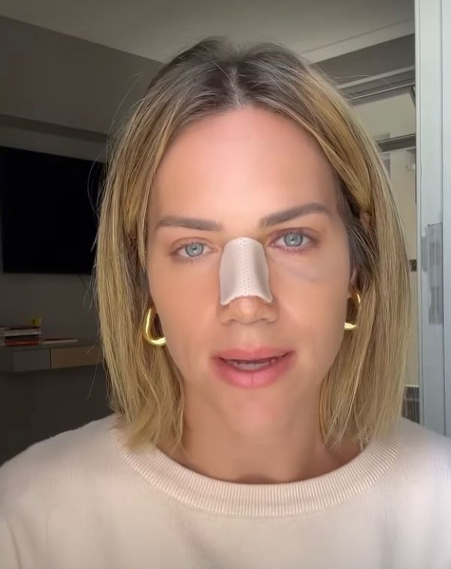 Desvio de septo e retirada de carne esponjosa: entenda as cirurgias feitas  por Giovanna Ewbank