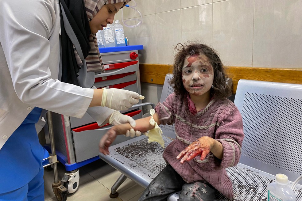Capacidade do hospital em Gaza de tratar os feridos foi prejudicada pela escassez de equipamentos essenciais — Foto: AFP