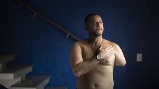  Alessandro Silva Ribeiro teve o braço amputado após ser atingido por um tiro de fuzil disparado por um policial militar na Penha — Foto: Márcia Foletto