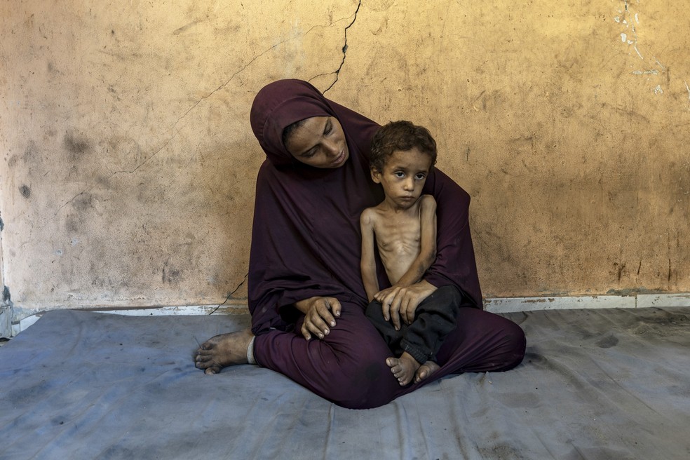 Criança palestina sentada no colo de sua mãe com sinais de desnutrição aguda em Gaza — Foto: Saher Alghorra/New York Times