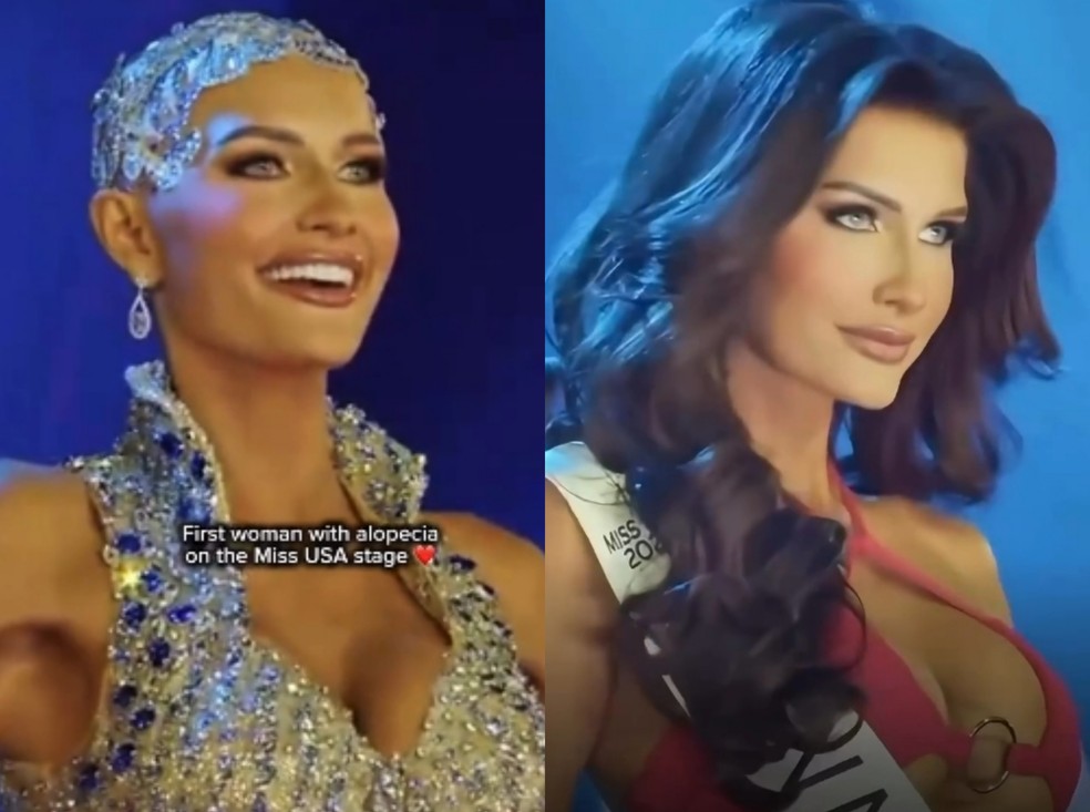Miss Nevada Mary Sickler mostra confiança e força com alopecia no Miss EUA — Foto: Reprodução Instagram @thequeenbeautynetwork