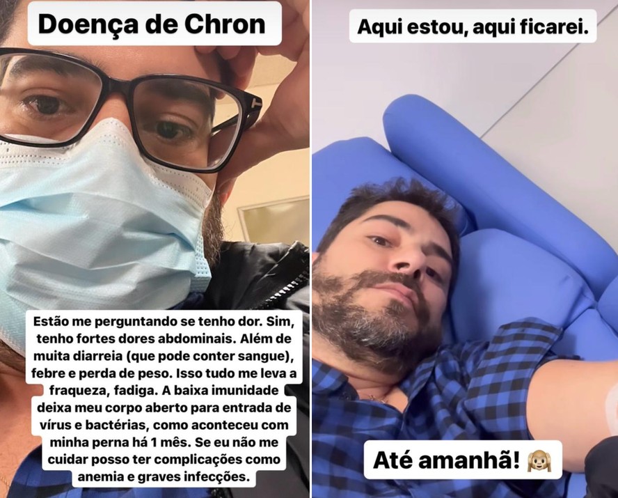 Doença de Crohn: conheça os sintomas da condição que levou à internação ...