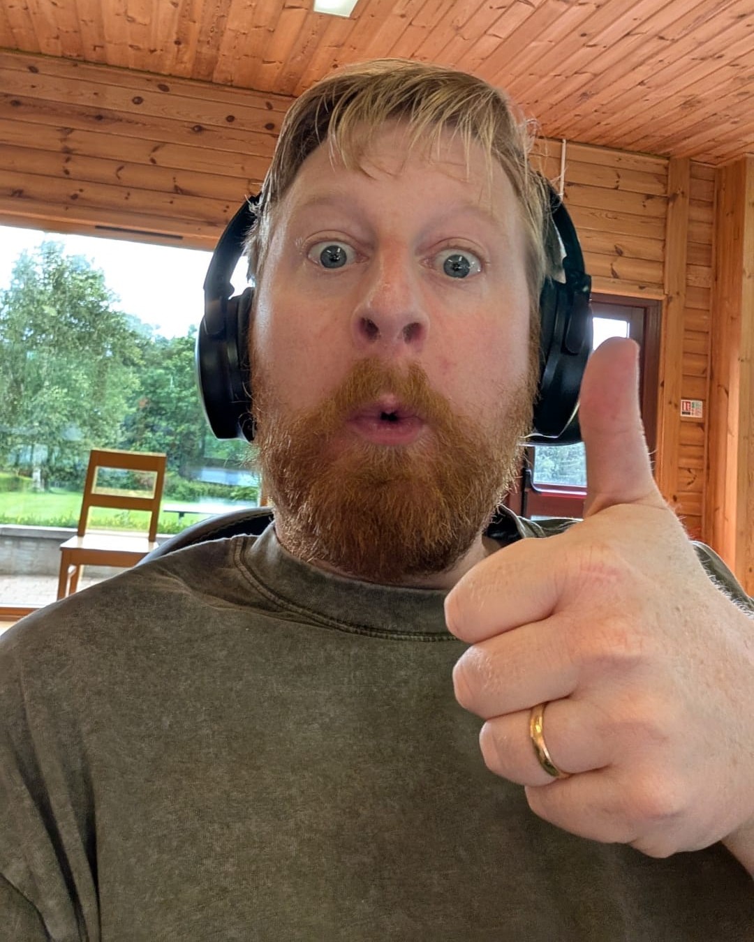 Ator que participou de 'Game of Thrones' morre por doença rara aos 35 anos