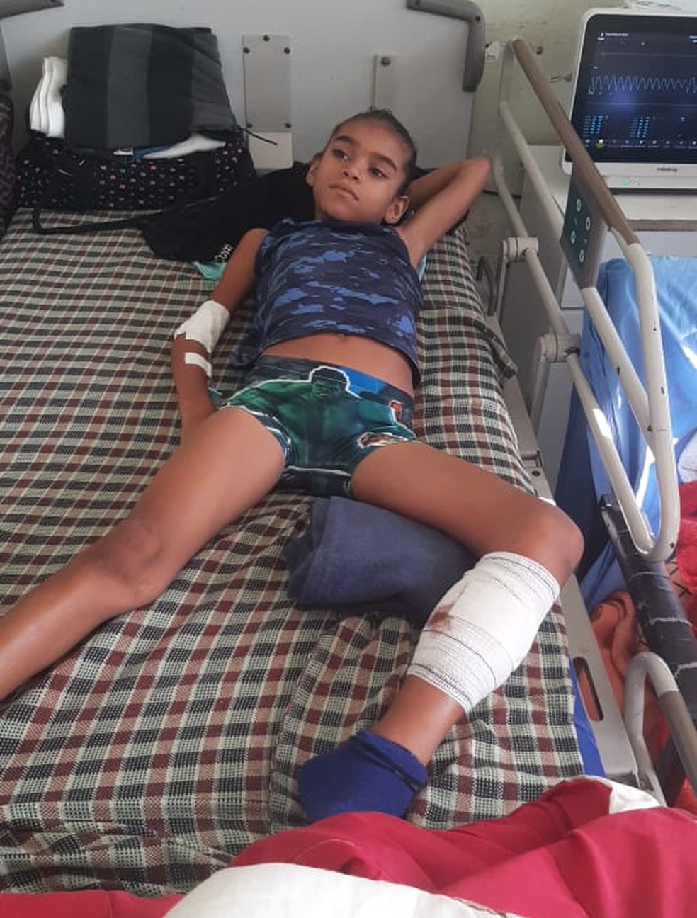 Nícolas se recupera de cirurgia na perna no Hospital municipal Souza Aguiar — Foto: Arquivo pessoal