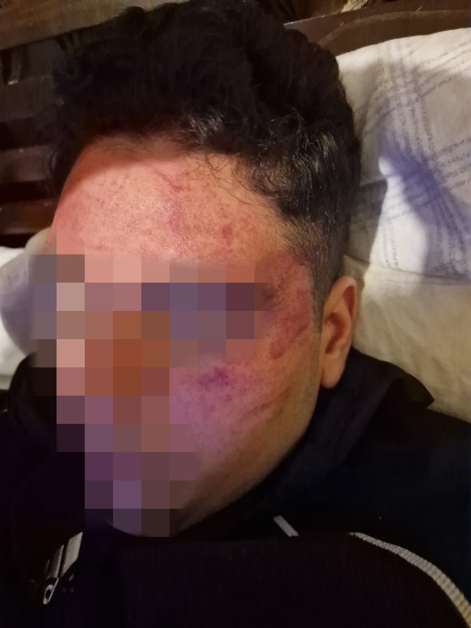 Brasileiro com autismo foge da escola em Portugal e é imobilizado por seis policiais: ʽRevoltanteʼ, diz a mãe