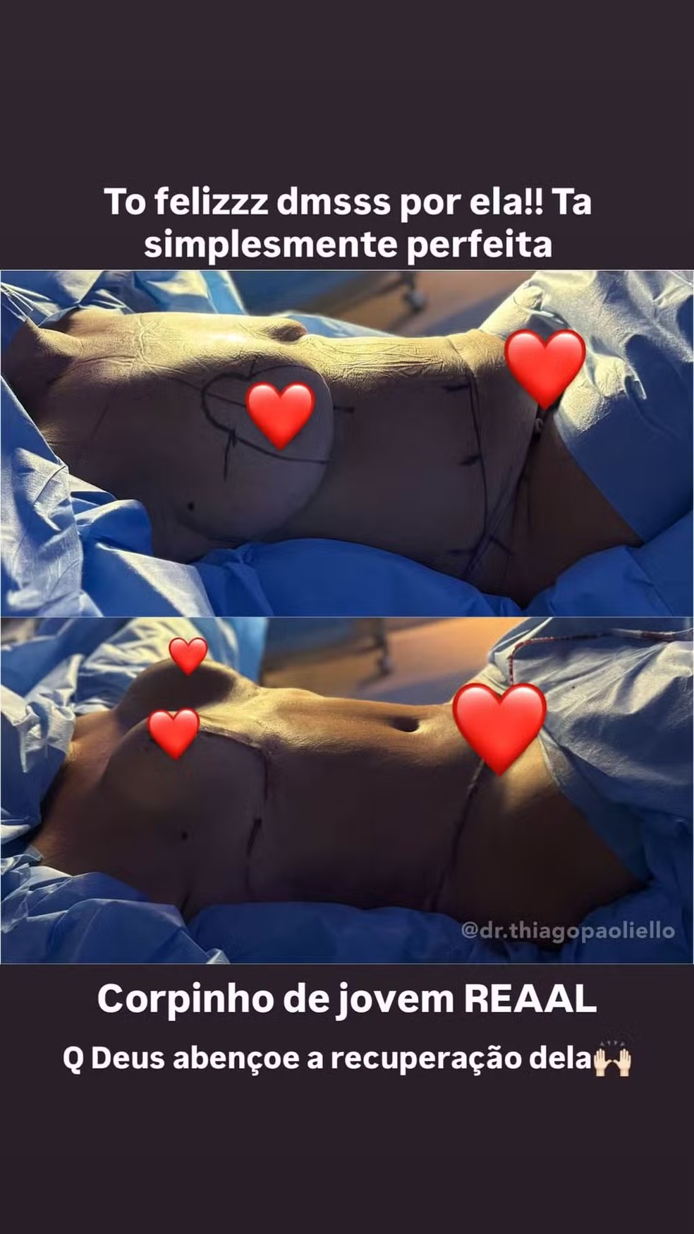 M&atilde;e de Virg&iacute;nia Fonseca, Margareth Serr&atilde;o passou por abdominoplastia e colocou silicone &mdash; Foto: Reprodu&ccedil;&atilde;o Instagram