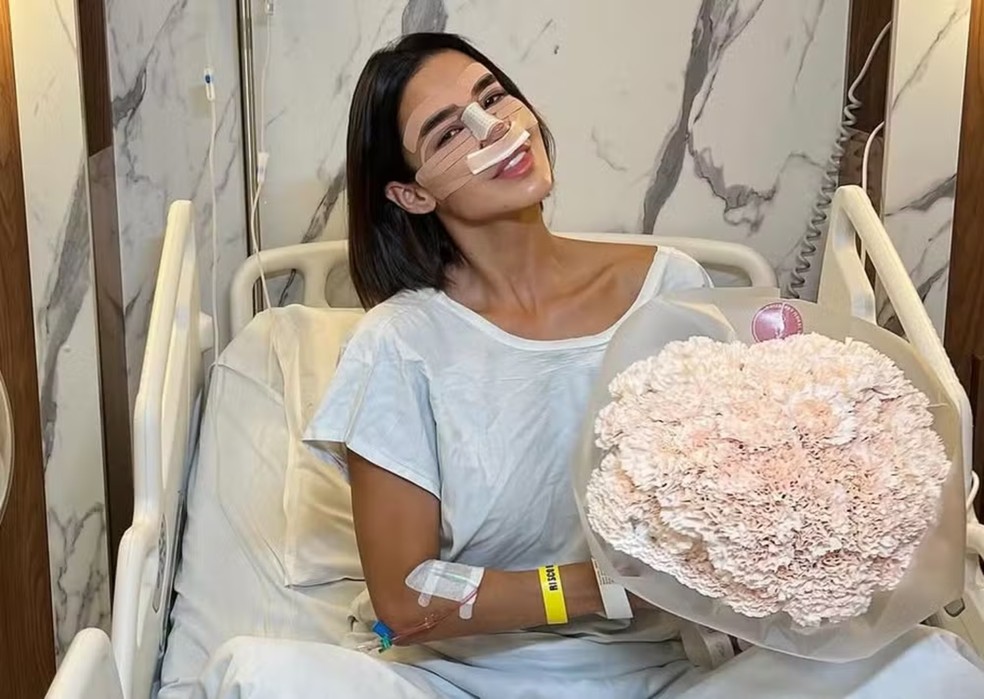 Kerline Cardoso faz rinoplastia e impulsiona busca por cirurgia com recuperação rápida — Foto: Reprodução Instagram