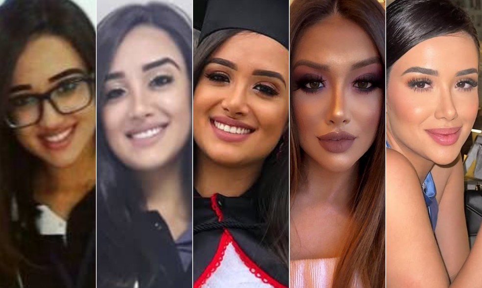 Antes e depois de Jordana, participantes do BBB 26, após gastar mais de R$ 40 mil em cirurgias plásticas — Foto: Reprodução/Instagram