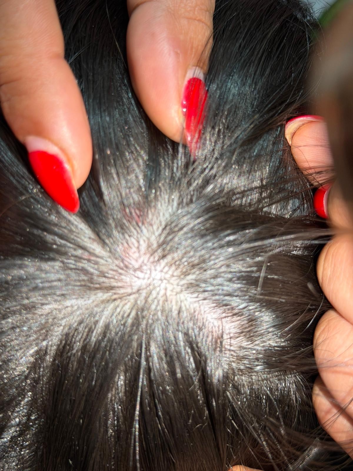 Xenofobia em escola de Portugal gera violência e brasileiro é agredido ...