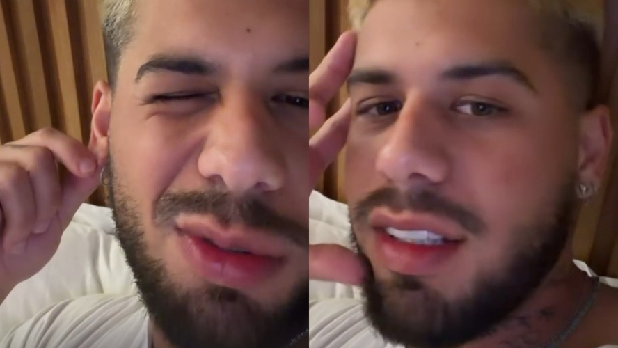 Zé Felipe passa por cirurgia após acidente doméstico e nódulo na orelha