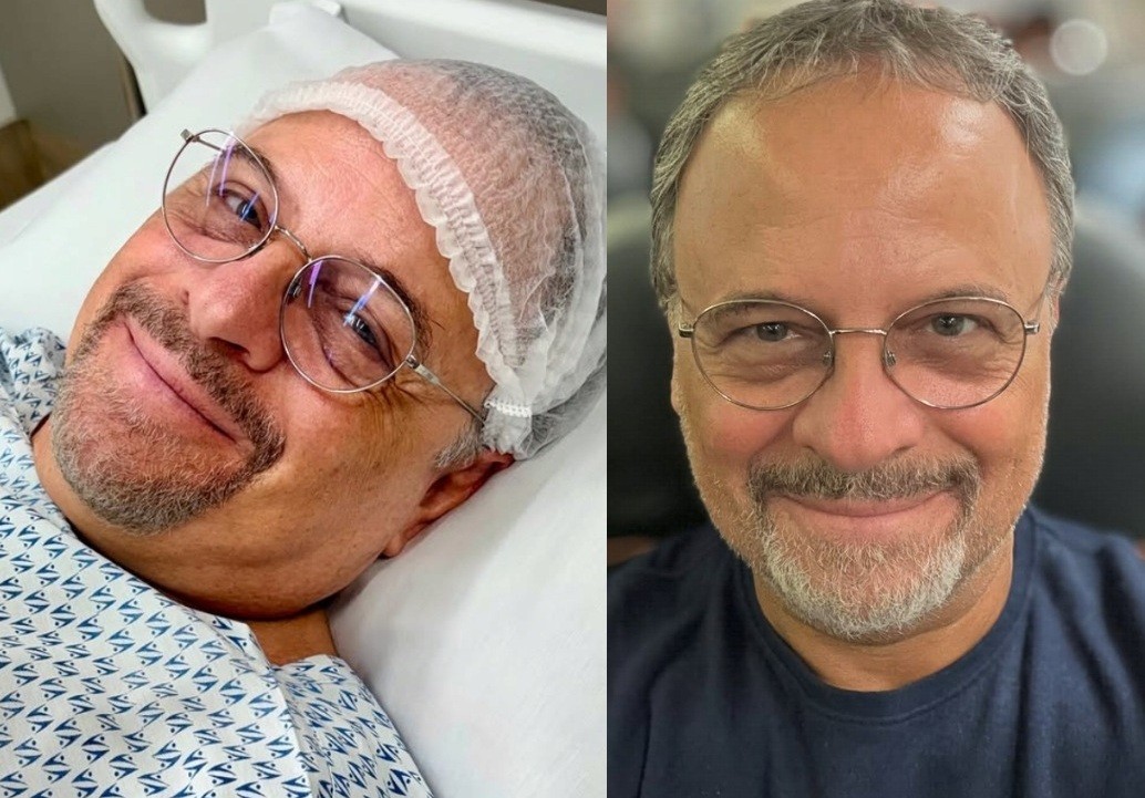 Astrólogo de famosas como Leticia Spiller e Julia Lemmertz, ator Marcos Breda fala da recuperação após décima cirurgia por acidente de moto: 'Jornada de dor inacreditável'