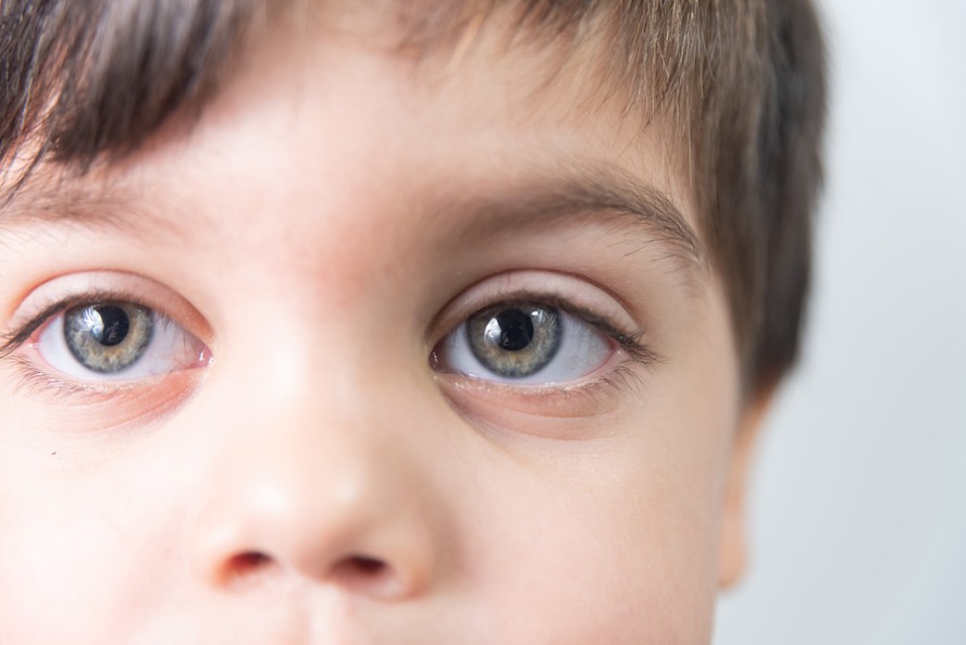 Alterações na retina podem funcionar como biomarcadores para o autismo.