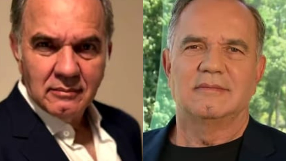 Harmonização facial: antes e depois do ator Humberto Martins — Foto: Reprodução SBT