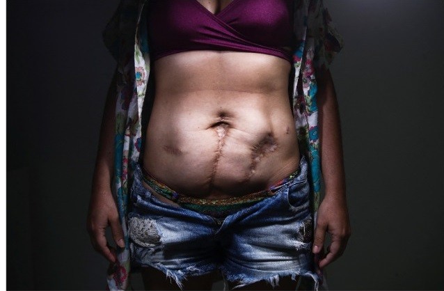 Fênix. O depois de sofrer violência doméstica – três facas na barriga – a capoeira Liliana, de 50 anos, reencontrou a autoestima com uma tatuagem fênix — Foto: Carla Carniel / Reuters