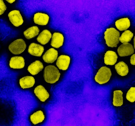 Micrografia eletrônica de transmissão colorida de partículas do vírus da varíola do macaco (amarelo) cultivadas e purificadas a partir de cultura de células. Imagem capturada no NIAID Integrated Research Facility (IRF) em Fort Detrick, Maryland, Estados Unidos.