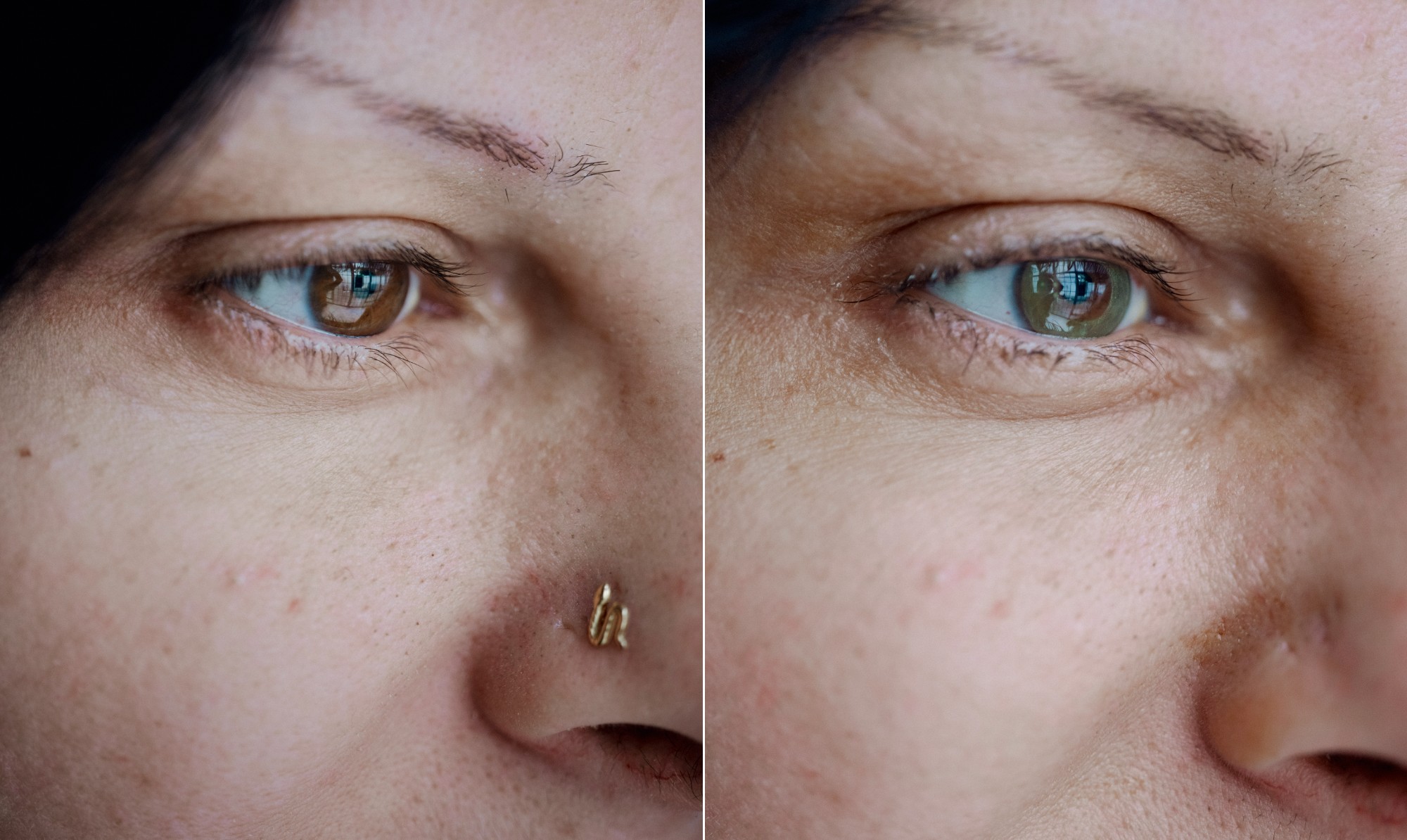 Médico Cria Técnica para Mudar Cor dos Olhos