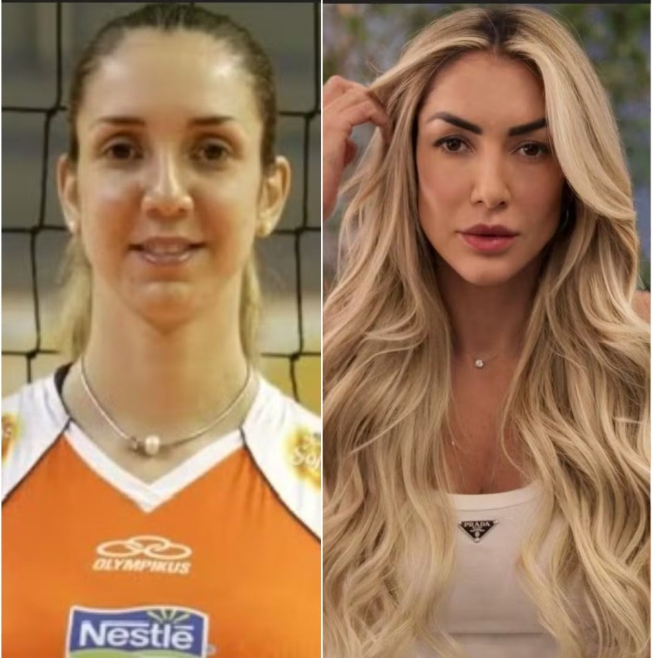 Thaísa Daher, da seleção feminina de vôlei, passou por harmonizações faciais, rinoplastia, colocou implante de silicone nos seios e  fez botox — Foto: Reprodução / Redes sociais