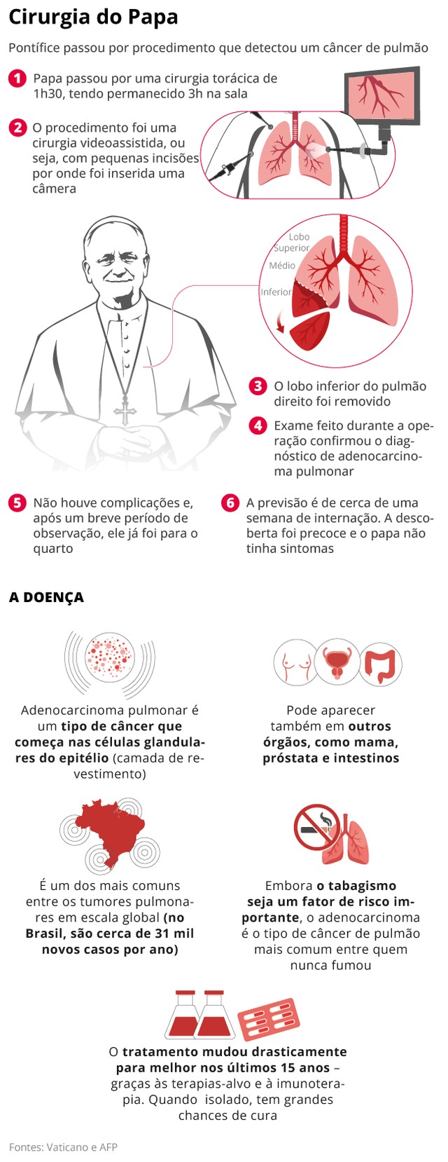 Papa Leão XIV começa a caminhar e apresenta recuperação ‘dentro do ...