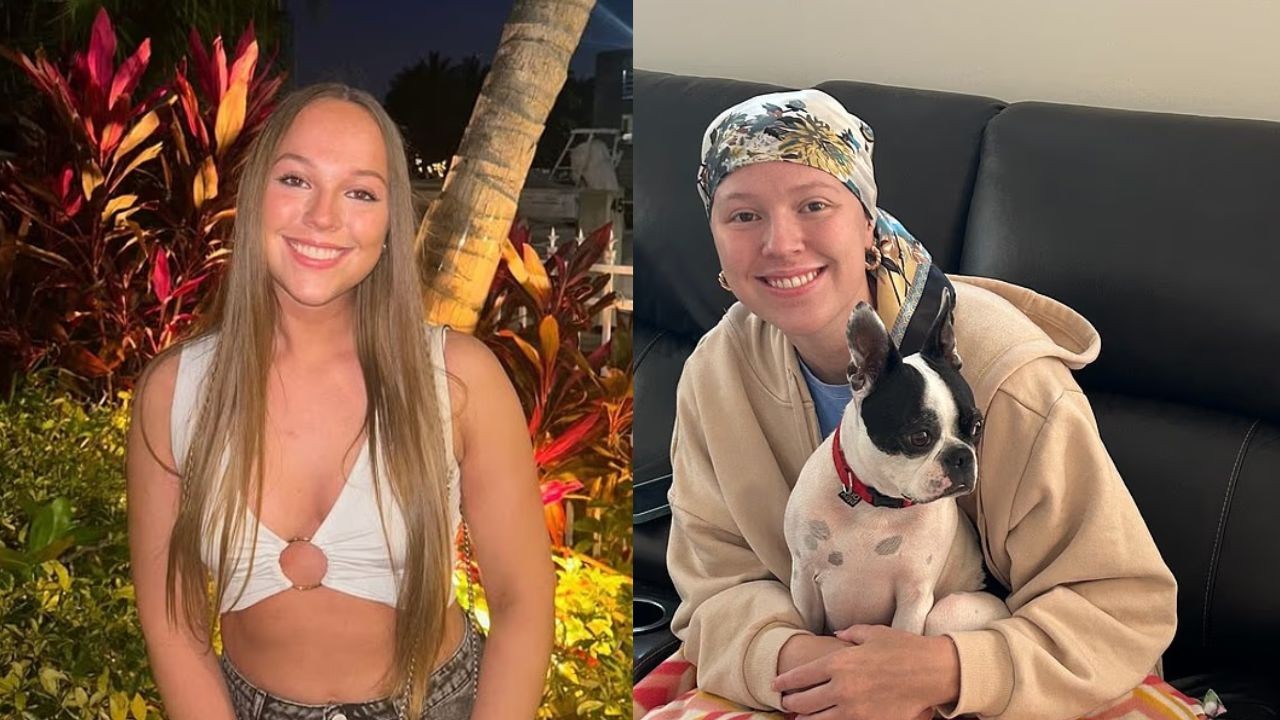 Cirurgia para retirar siso leva jovem de 21 anos a descobrir leucemia nos EUA