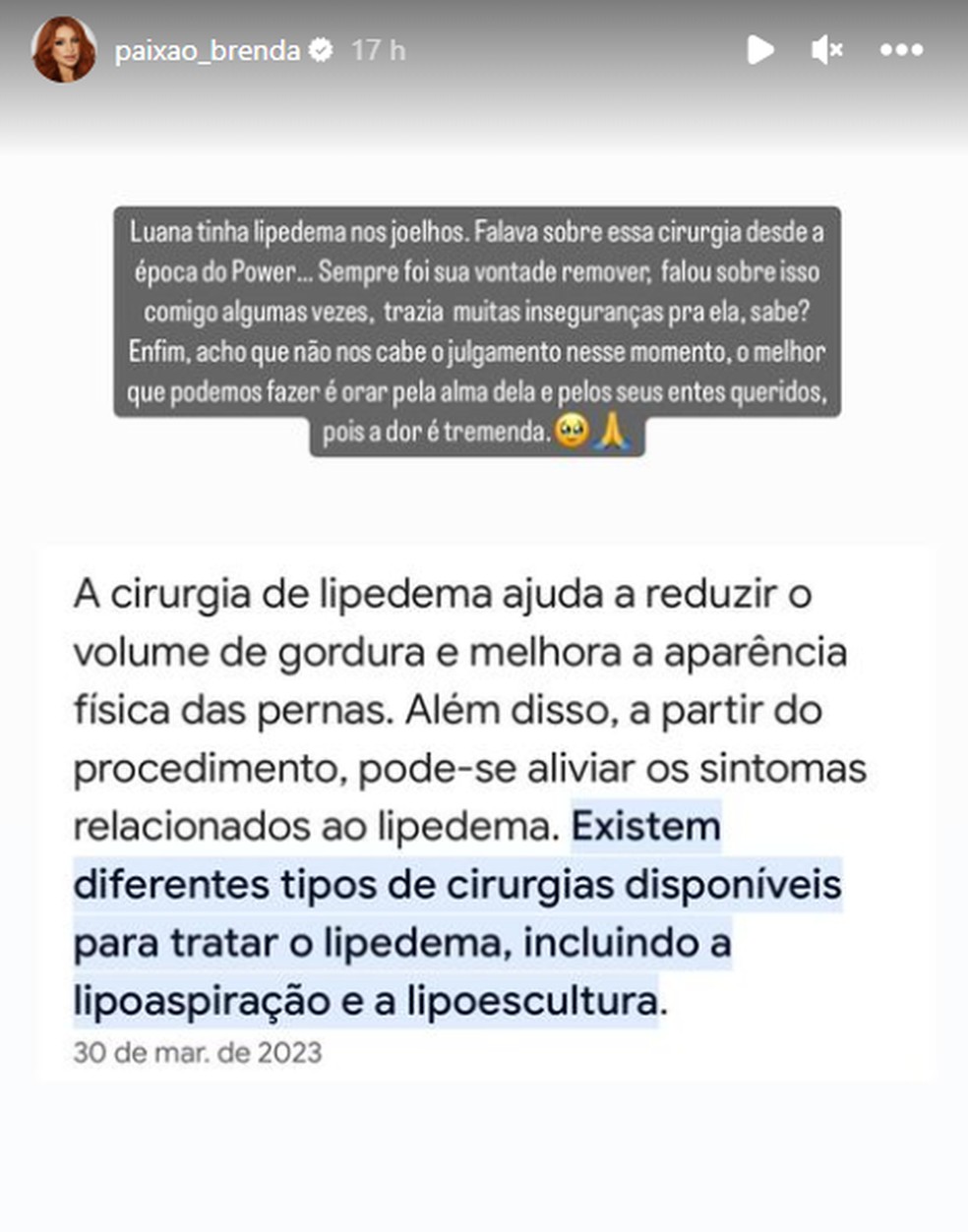 Amiga revela desabafo de Luana Andrade sobre lipo no joelho: 'Trazia muitas  inseguranças