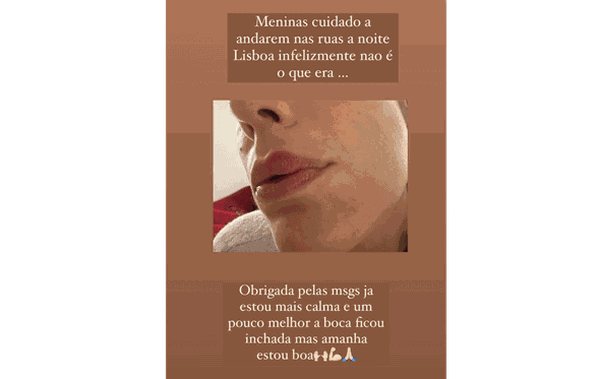 Foto da Recomendao