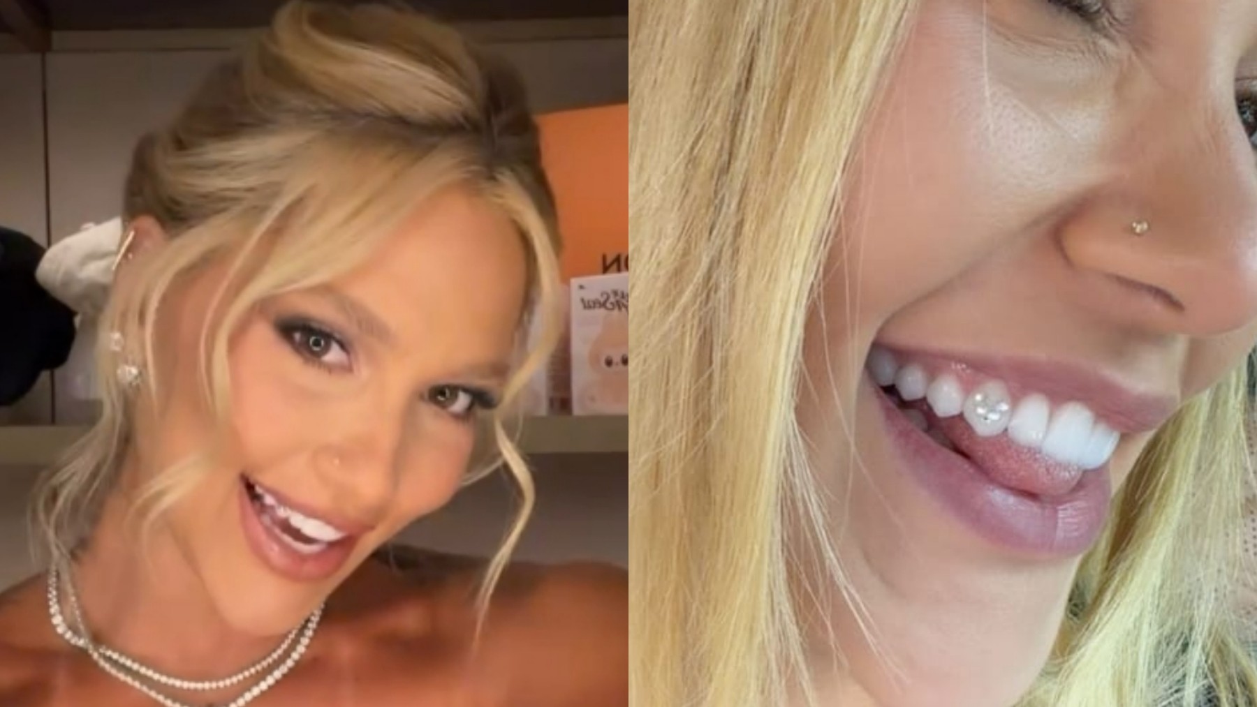 Tooth gem: o que é a joia dental usada por Virginia Fonseca e quais os cuidados