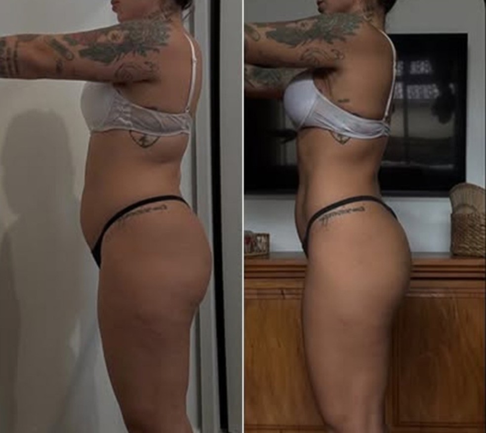 Petra Mattar mostrou antes e depois do emagrecimento — Foto: Reprodução Instagram