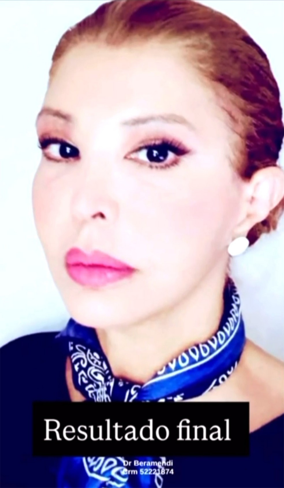 Roberta Close — Foto: Reprodução Instagram