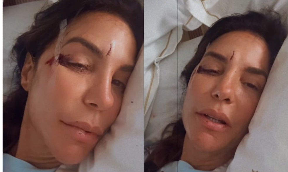 Ivete Sangalo recebe alta de hospital e detalha o que aconteceu; entenda o  que é 'desmaio vasovagal'