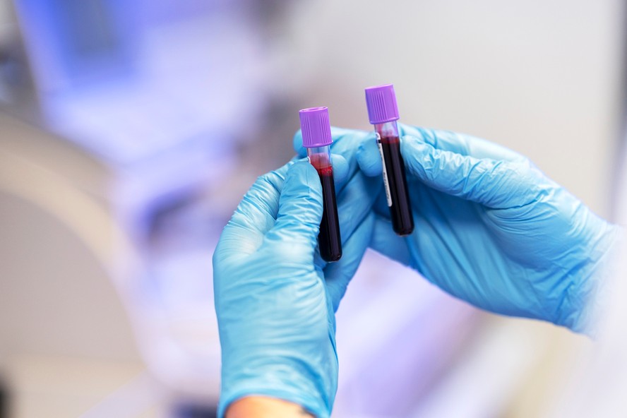 Casos de HIV e Aids crescem no Brasil pelo terceiro ano consecutivo