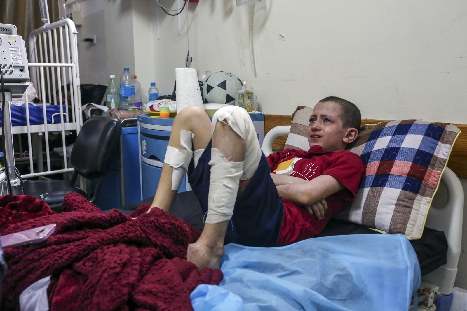 Mohamed Abu Rteinah, 12 anos, que foi queimado quando uma bomba atingiu sua casa no final de outubro de 2023, se recupera em Gaza em novembro. — Foto: Samar Abu Elouf/The New York Times